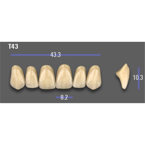 VITA MFT Upper Anterior Classical Shade A2 Mould T43