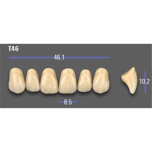 VITA MFT Upper Anterior Classical Shade A2 Mould T46
