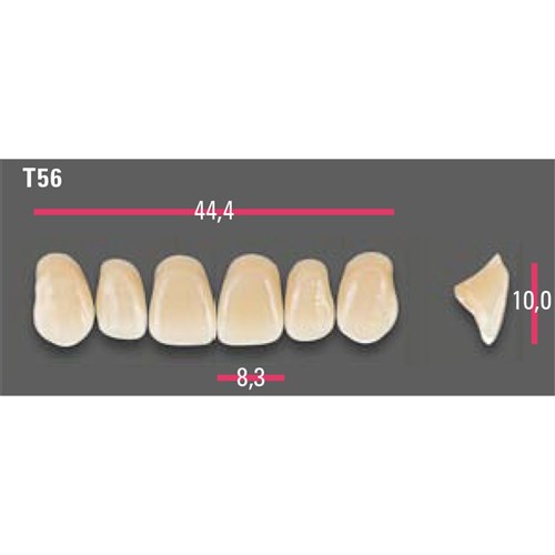 Vitapan Anterior Shade A1 Upper Mould T56 Set 6