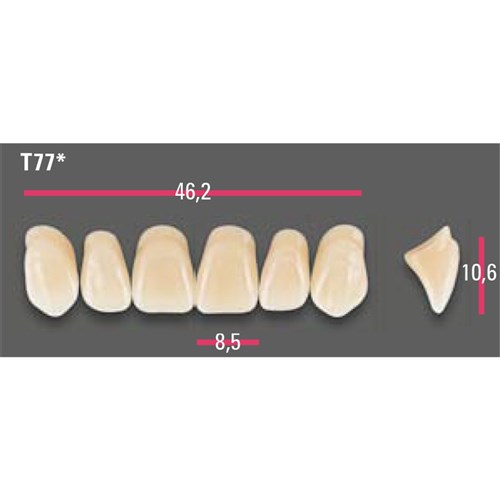 Vitapan Anterior Shade A1 Upper Mould T77 Set 6