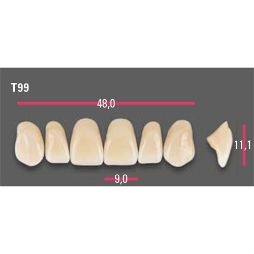 Vitapan Anterior Shade A1 Upper Mould T99 Set 6