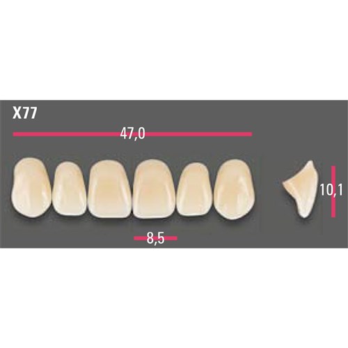 Vitapan Anterior Shade A1 Upper Mould X77 Set 6