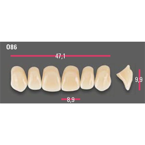 Vitapan Anterior Shade A2 Upper Mould O86 Set 6