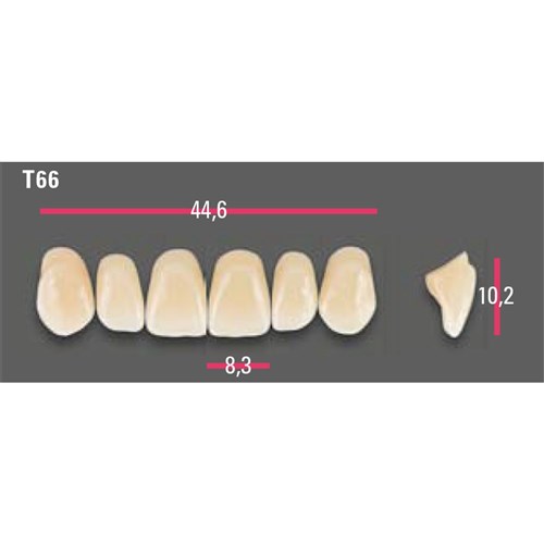 Vitapan Anterior Shade A2 Upper Mould T66 Set 6