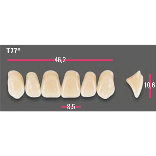 Vitapan Anterior Shade A2 Upper Mould T77 Set 6