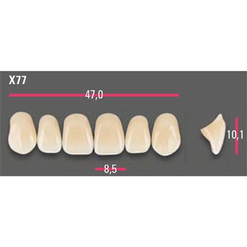 Vitapan Anterior Shade A2 Upper Mould X77 Set 6