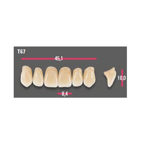 Vitapan Anterior Shade B3 Upper Mould T67 Set 6