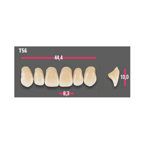 Vitapan Anterior Shade C4 Upper Mould T56 Set 6