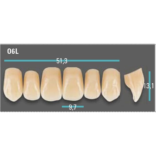 Physiodens Anterior Shade A1 Upper Mould O6L Set 6