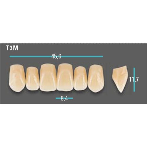 Physiodens Anterior Shade A2 Upper Mould T3M Set 6