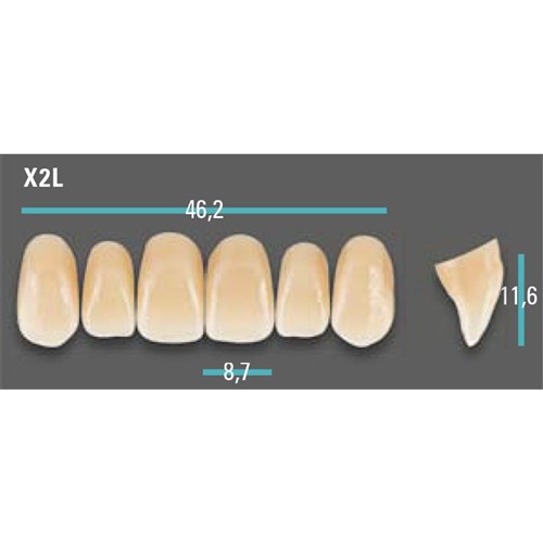 Physiodens Anterior Shade A2 Upper Mould X2L Set 6