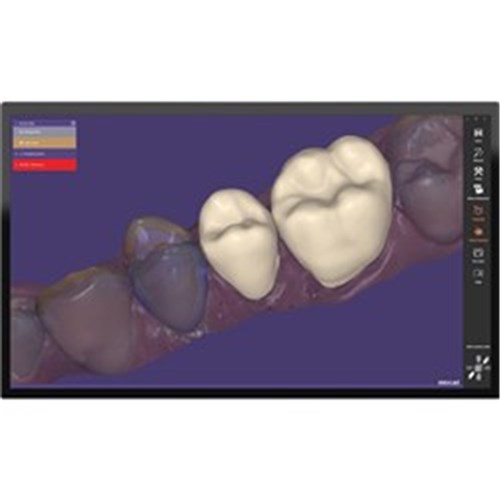 Exocad DentalCAD Provision Module Flex