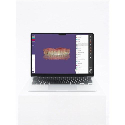 Exocad DentalCAD Dental DB Flex