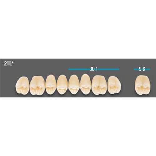 VITA Lingoform Upper Posterior Shade 0M3 Mould 21LU 3D-MASTER