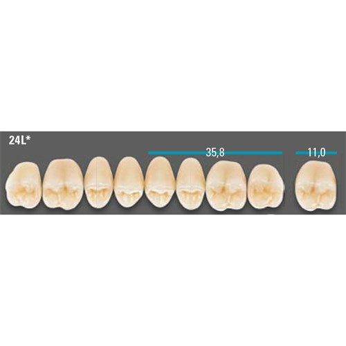 VITA Lingoform Upper Posterior Shade A1 Mould 24L Classical