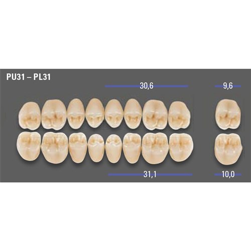 MFT 1M1 PL31 Post Lower x8