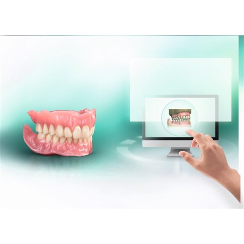 VITA VIONIC VIGO Posterior A1 22L OK