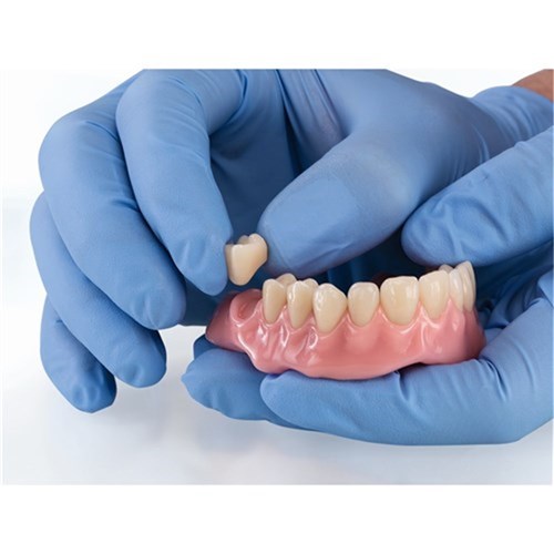 VITA VIONIC VIGO Posterior D3 21L UK