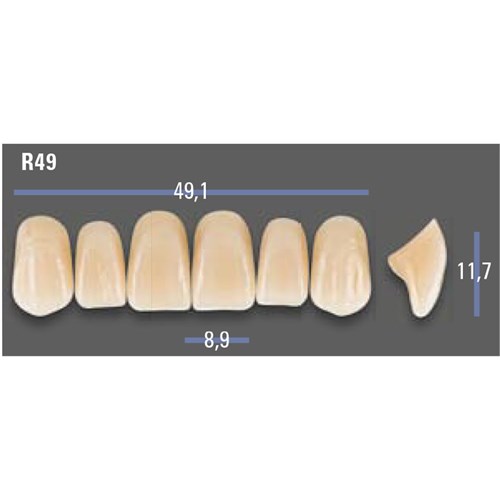VITAPAN EXCELL Classical Upper Anterior Shade A1 Mould R49