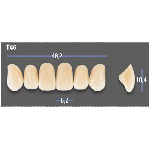 VITAPAN EXCELL Classical Upper Anterior Shade A1 Mould T46
