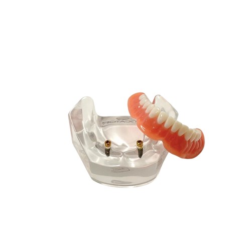 LOCATOR Removable Patient Education Suite 2 Models