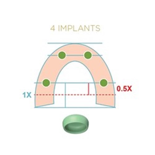 LOCATOR FIXED Processing Pack 4 Unit Green