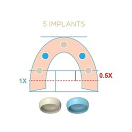 LOCATOR FIXED Processing Pack Anterior/Posterior Tan