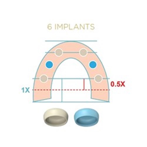 LOCATOR FIXED Processing Pack Mid Arch Blue